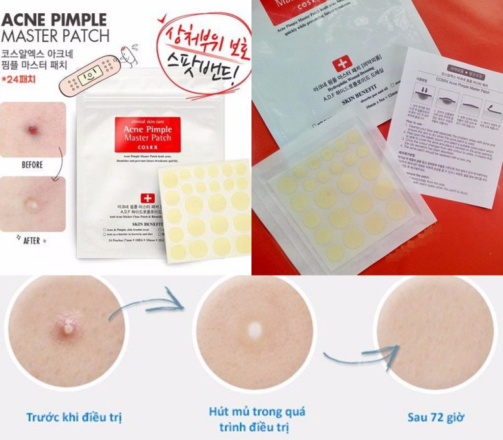 Công dụng COSRX Acne Pimple Master