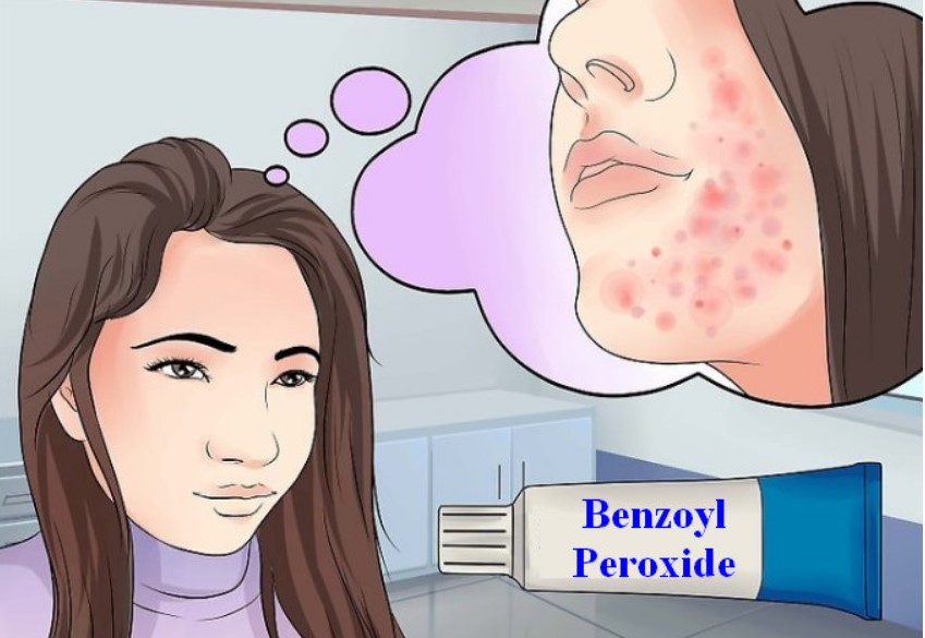 Benzoyl peroxide và Salicylic dùng cùng nhau được không?