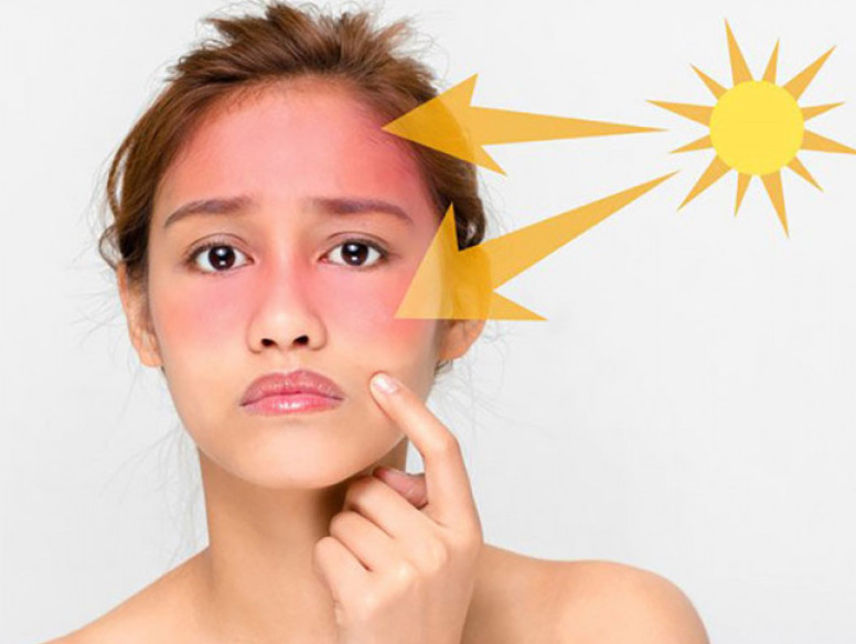 Các tia cực tím (tia UV) khiến cho các tế bào da bị tổn thương